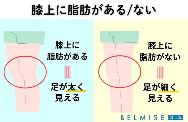 膝上に脂肪がのっている