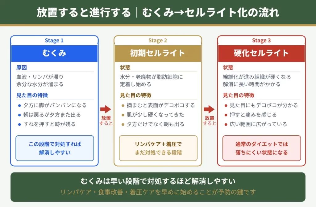 むくみが慢性化するとセルライトになる