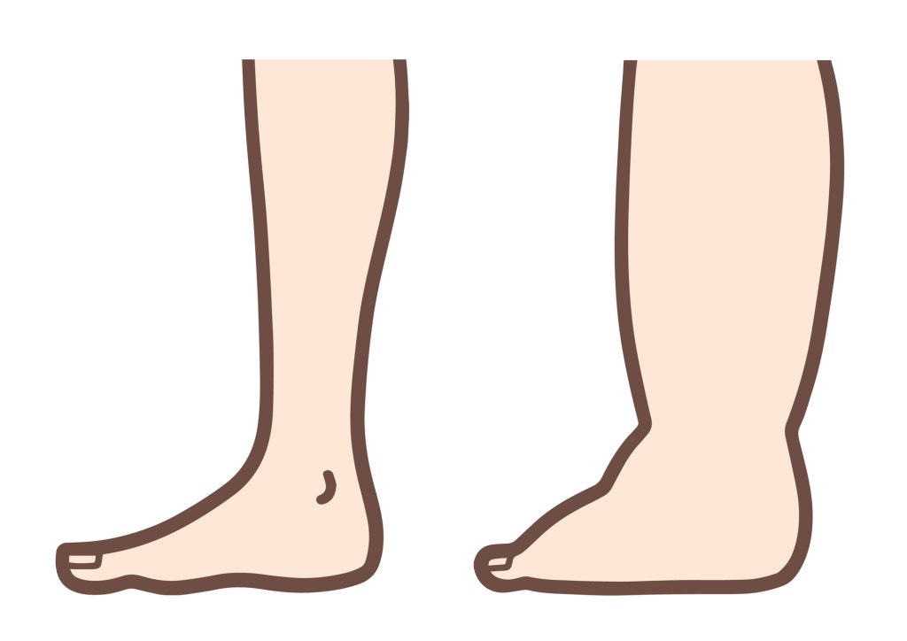 足首サイズ比較