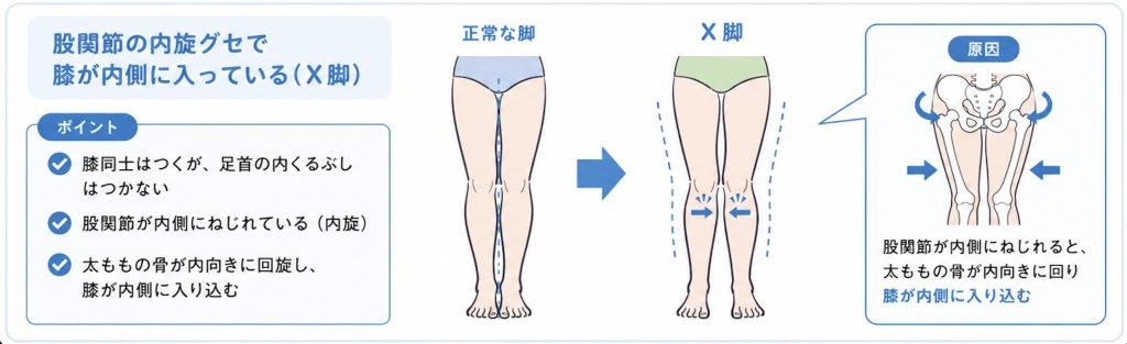 X脚