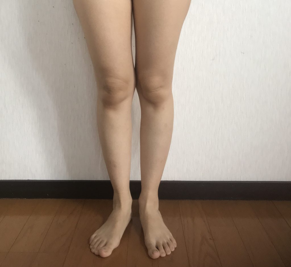 着用前太もも